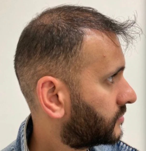Before image